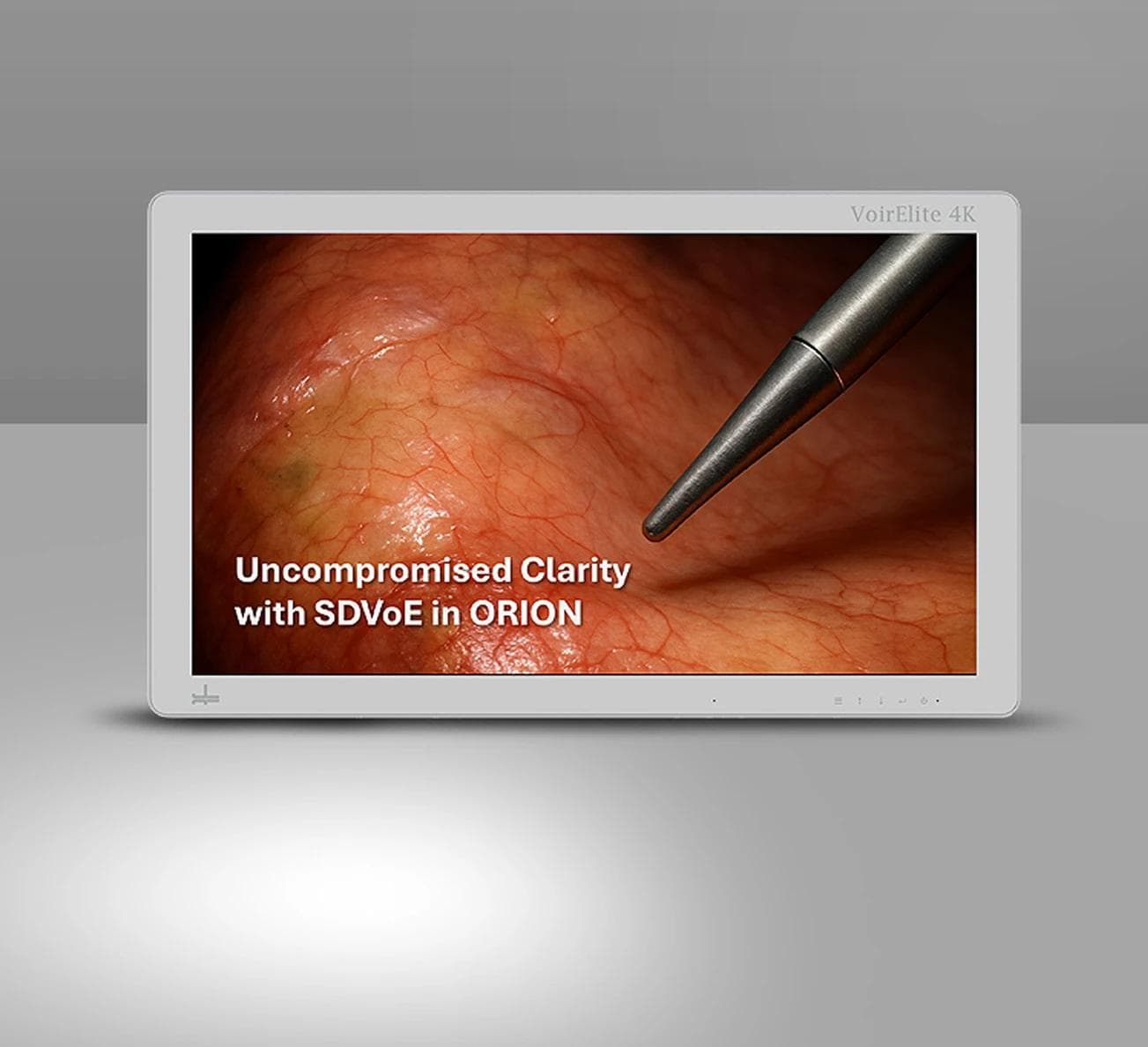 Whitepaper: Unveiling Visual Lossless Endoscopic Video Transmission through SDVoE Technology